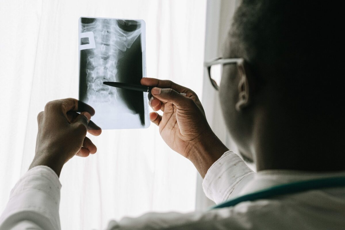Estudo com pacientes mostra que tratar nervo comprimido com reabilitação clínica tem mesma eficácia de cirurgia